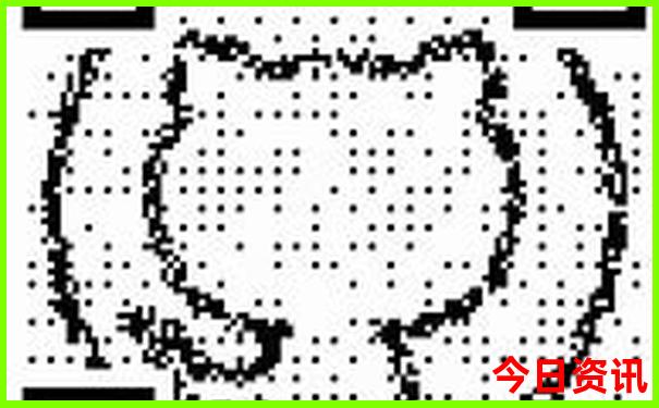 去新疆旅游必去的景点
